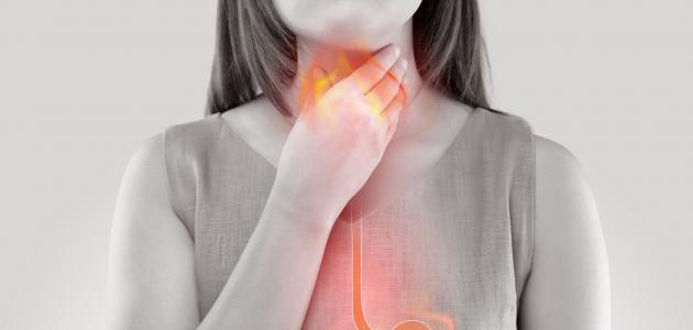 علاج تقلصات المريء تقلصات المريء