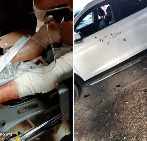 تفاصيل استهداف الدكتور ناصر الدين الشاعر بالرصاص جنوب نابلس !